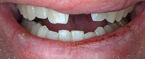 before and after case 2 - before